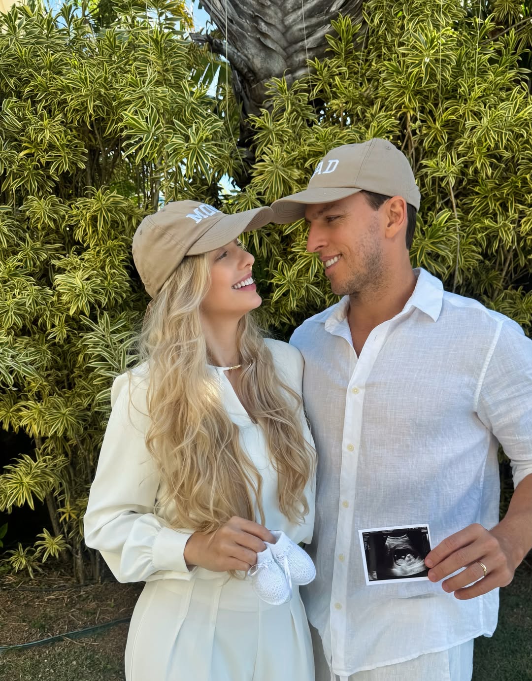 Mistério e expectativa: Amaury Nunes e Gabriela Buraick escondem sexo do bebê