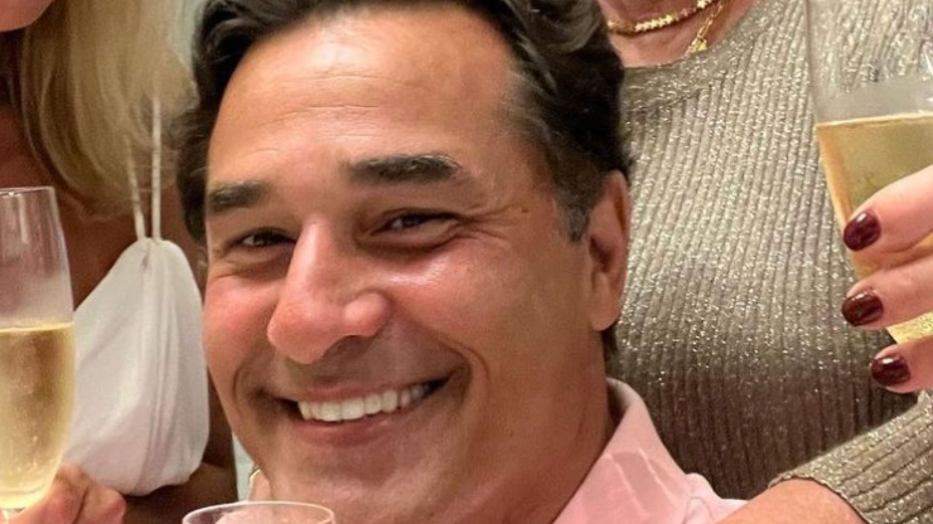 Luciano Szafir passa por harmonização facial e divide opiniões na web