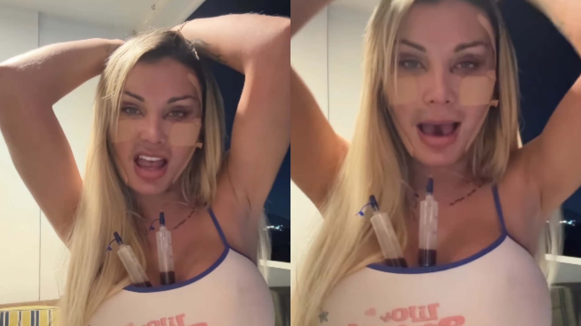 Andressa Urach causa estranhamento ao exibir rosto modificado em vídeo