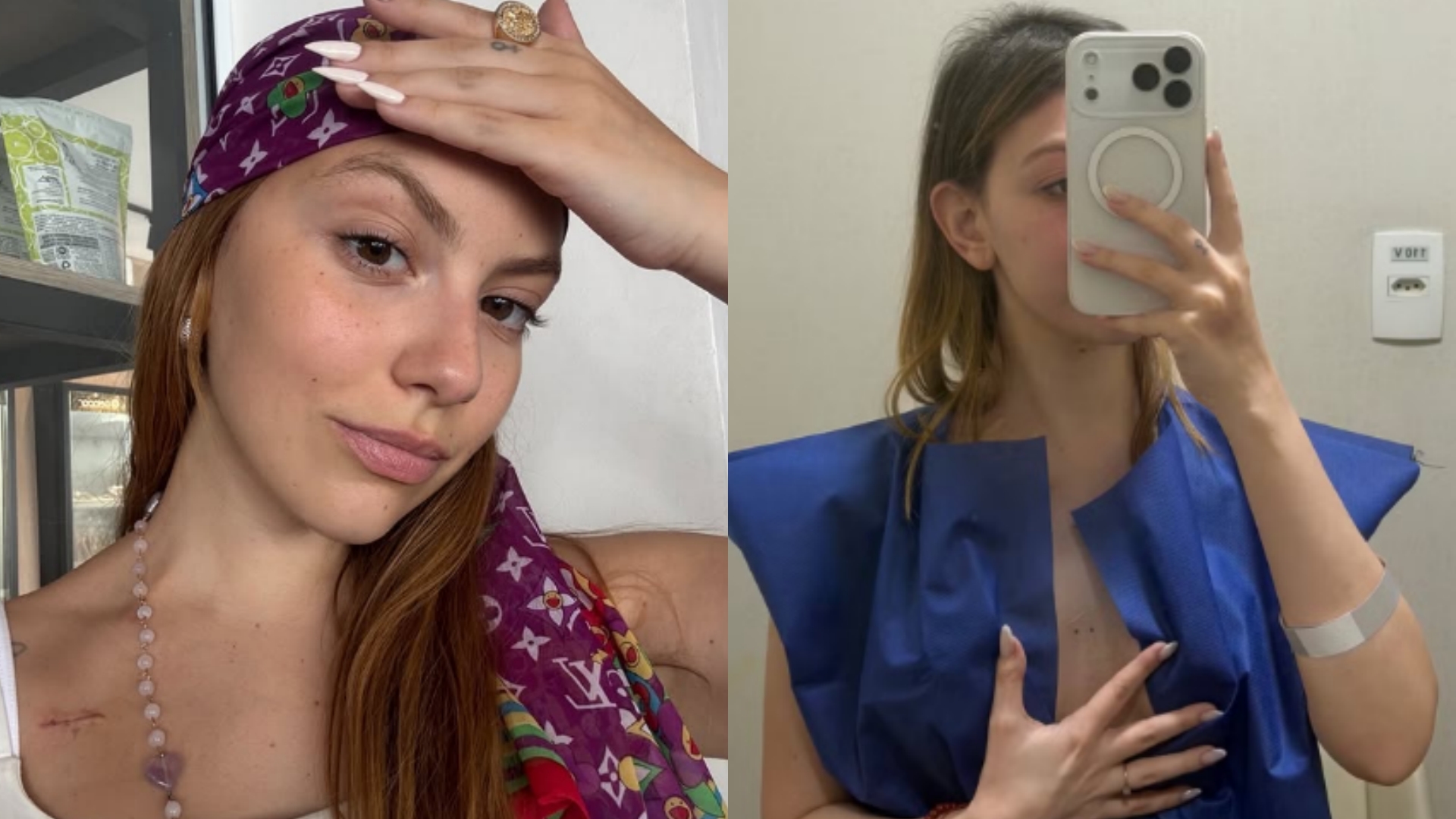 Bruna Furlan, neta de Carlos Alberto de Nóbrega, relata início de radioterapia