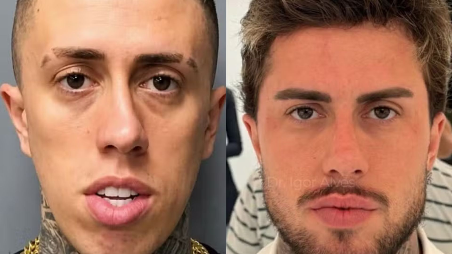 MC Daniel exibe transformação facial radical e surpreende fãs nas redes sociais
