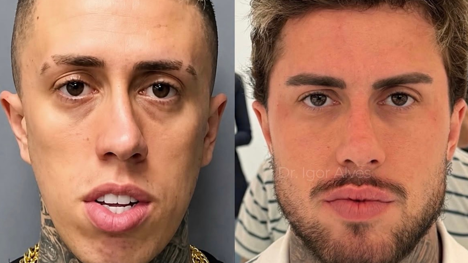 MC Daniel: a mudança radical que impulsiona o debate sobre a estética masculina