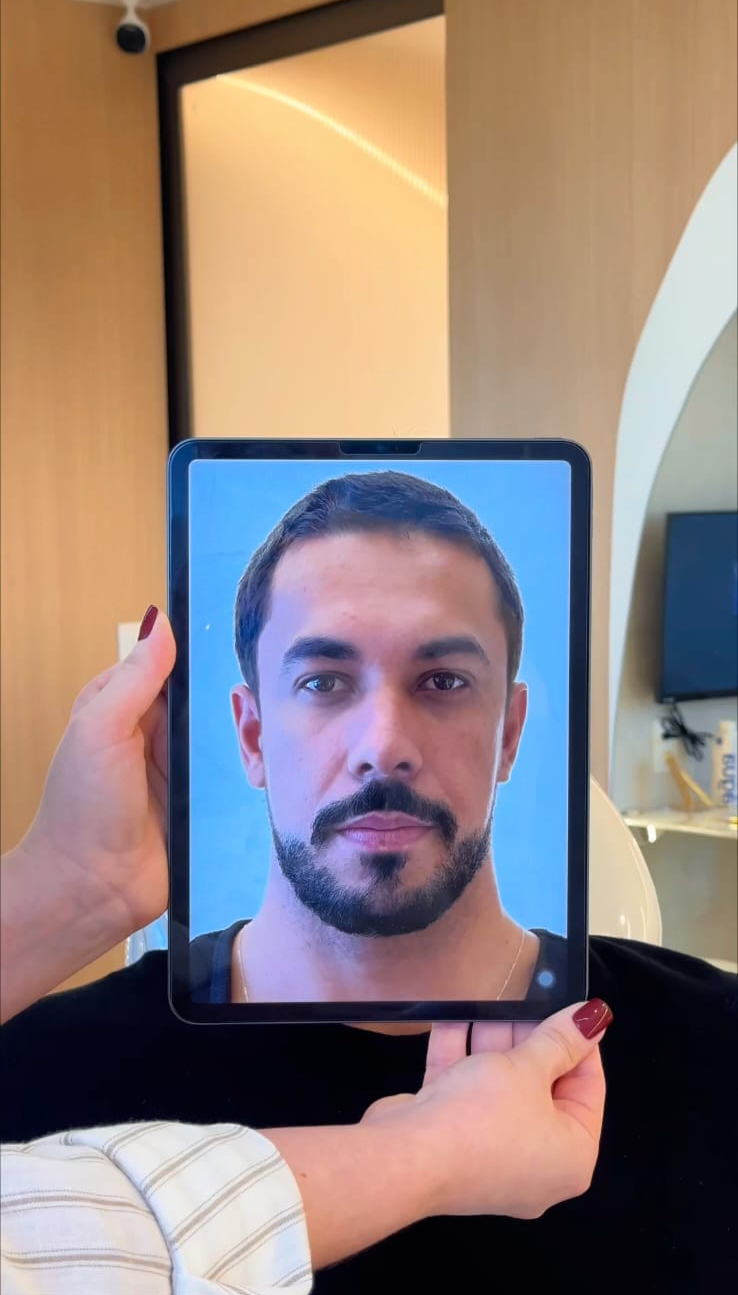 Maike Allan realiza harmonização facial e prioriza naturalidade após o BBB25