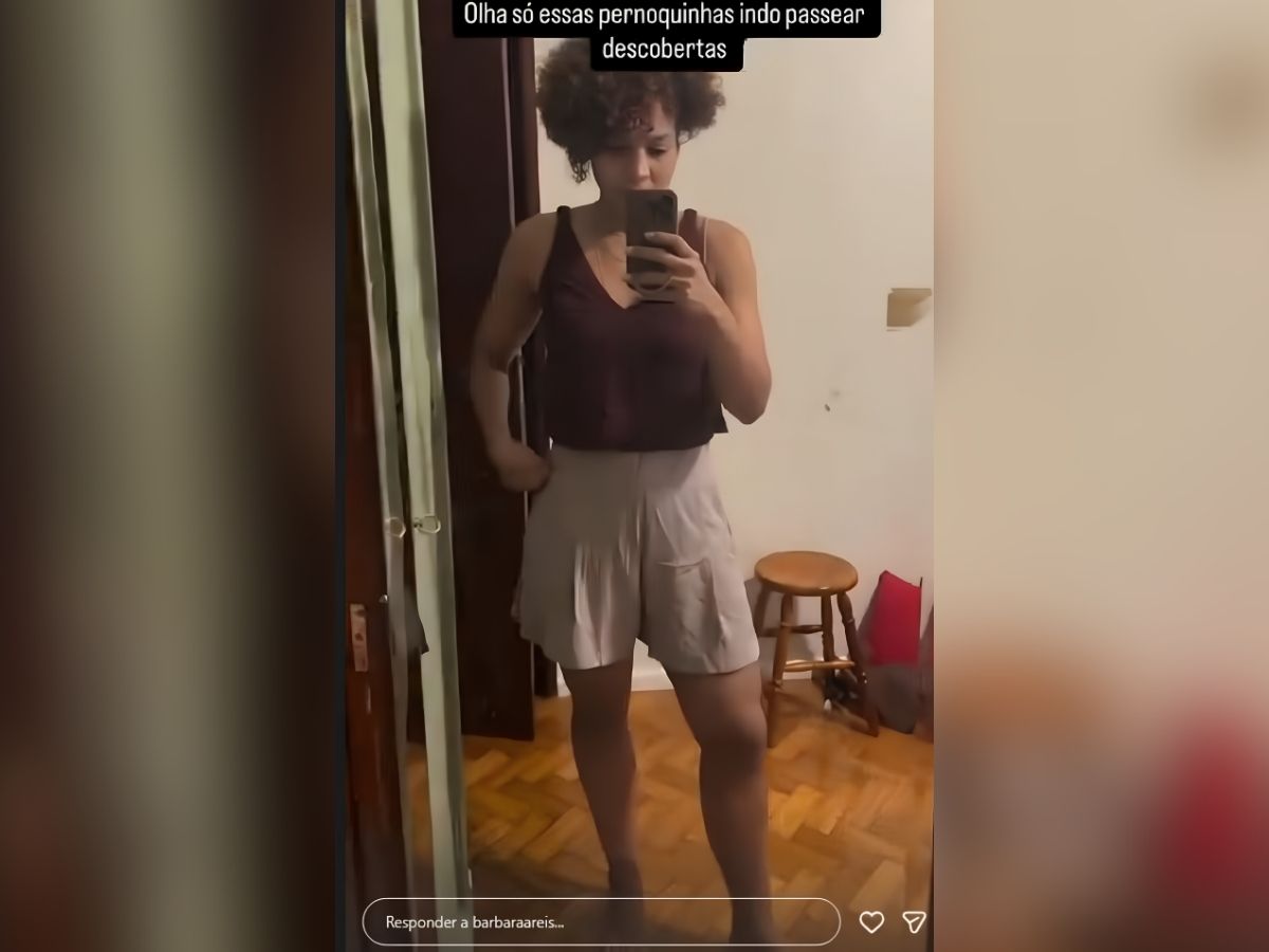 Barbara Reis celebra 75 dias de cirurgia de lipedema com conquista pessoal