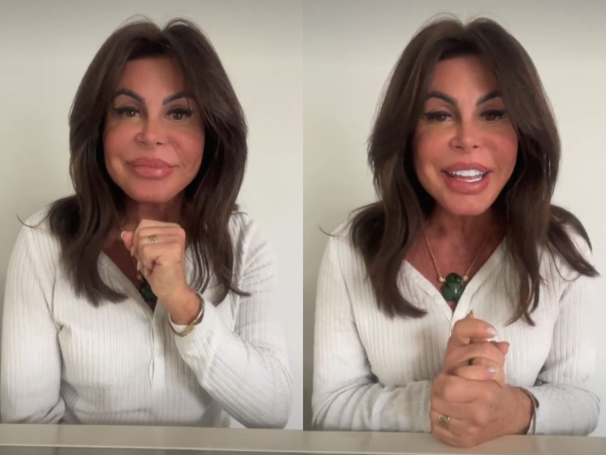 Por alopecia agressiva, Gretchen raspa cabelo em live e fará transplante capilar